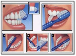 brushing